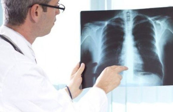 Cancro do pulmão com programa nacional de rastreio